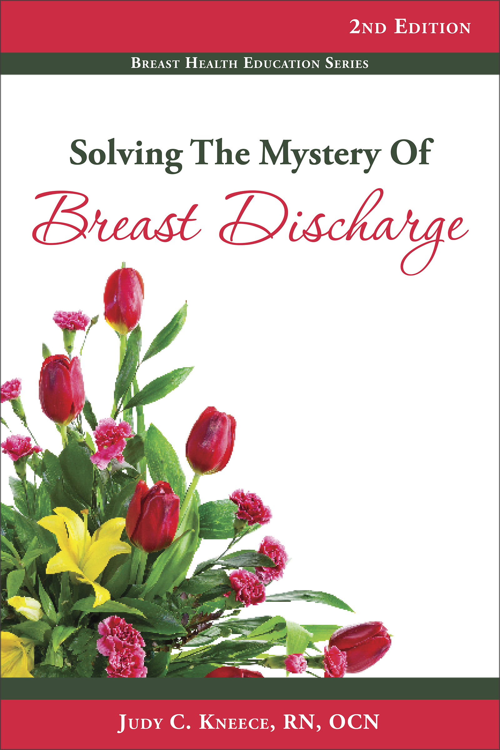 Solving the Mystery of Breast Discharge